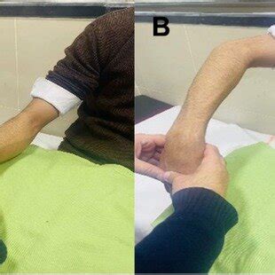 wrist hyperflexion tests